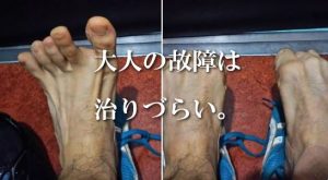 大人の故障は治りづらい。